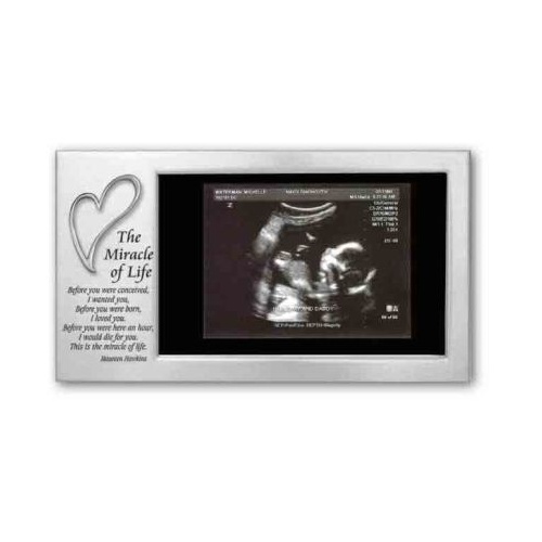 BABY PHOTOFRAME MIRACLE OF LIFE           